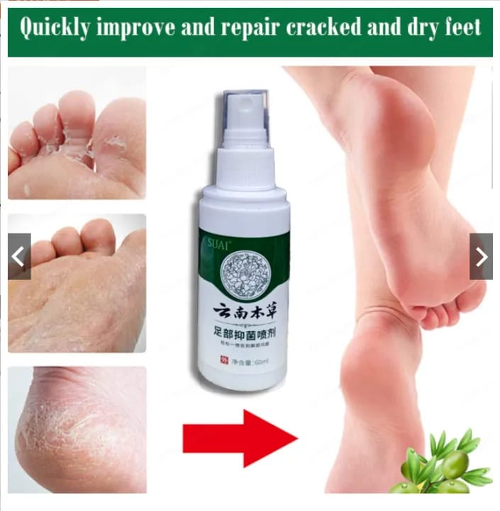 feet med.1